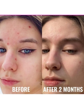 Serum niacinamida facial Good Molecules Niacinamida todo tipo de piel 30 ml