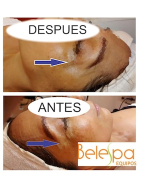 Masajeador facial Ocoac