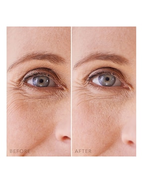 Parches para ojeras Foreo IRIS