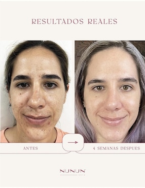 Sérum reafirmante Anti-Aging Nunun Skin de piel normales y sensibles
