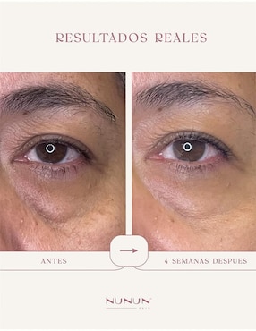 Sérum contorno de ojos Nunun Skin todo tipo piel