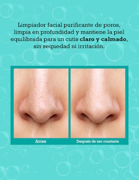 Tratamiento facial Clear Genius Cleanser antiacné Bliss