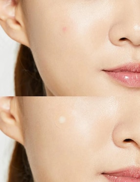 Parches para acné pimple master Cosrx