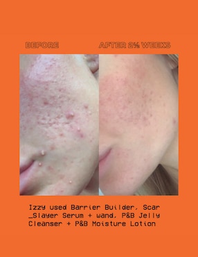 Sérum antimanchas Glow Hub The Vitamin C Scar Slayer todo tipo piel