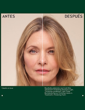 Sérum anticaída para cuero cabelludo Invati Ultra Advanced Revitalizante