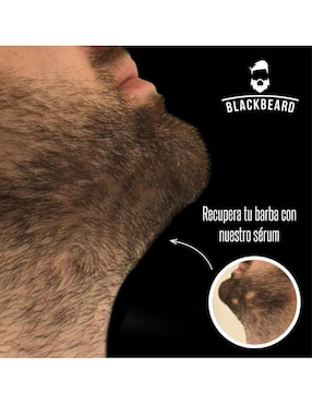 Tratamiento para barba y cabello anticaída Blackbeard