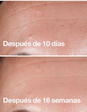 Sérum revitalizante Biotiks de piel sensible