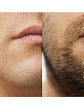 Tratamiento para barba y cabello crecimiento Lonitab