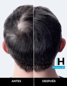 Set tratamiento capilar dúo prevención caída shampoo + loción anti caída con prohairin B4 Barcelona Pharma