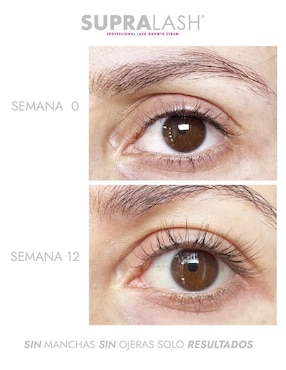 Sérum fortalecedor para pestañas alargador y fortalecedor clínico 2.9 ml Supralash de piel normal y sensible