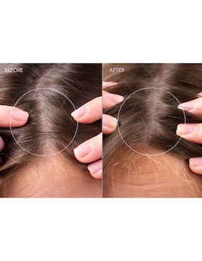 Sérum para cuero cabelludo Scalp Recovery Faq