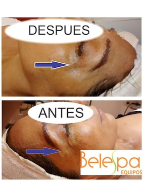 Kit tonificación facial Ocoac V1.0