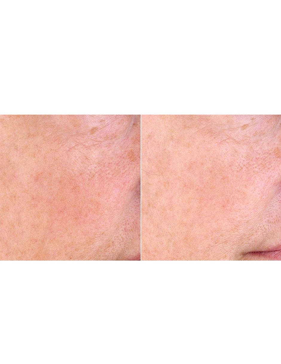 Masajeador facial 4