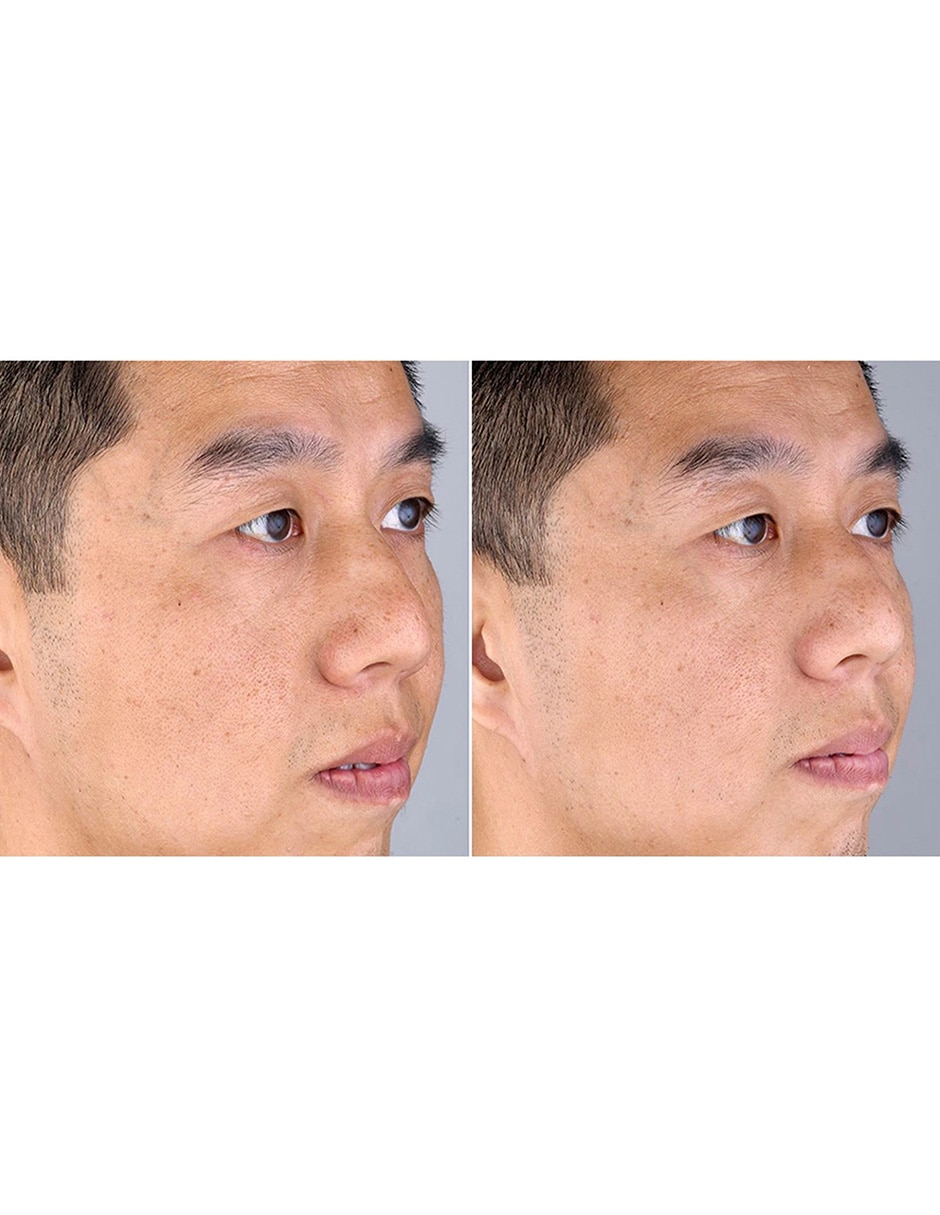 Masajeador facial 5