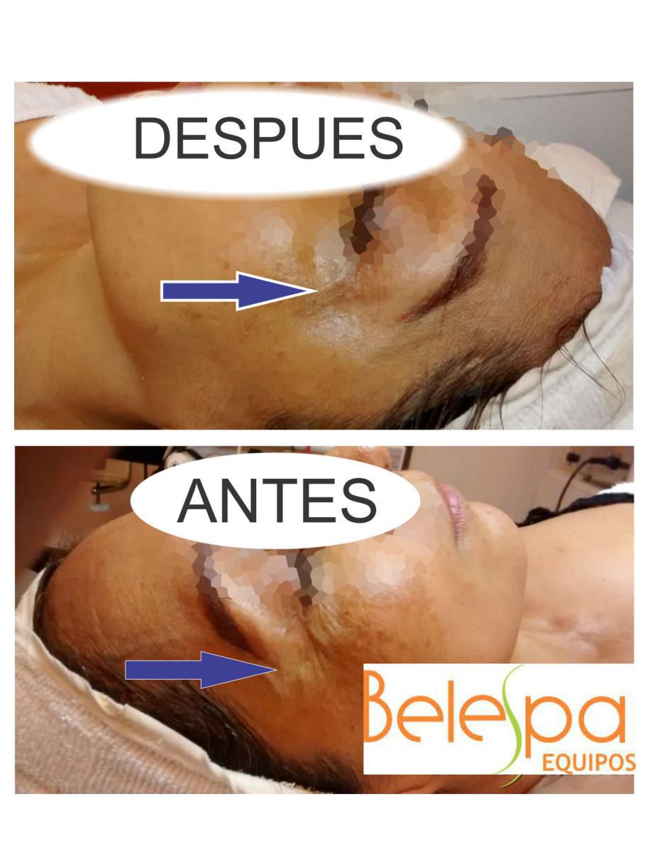 Masajeador facial 4
