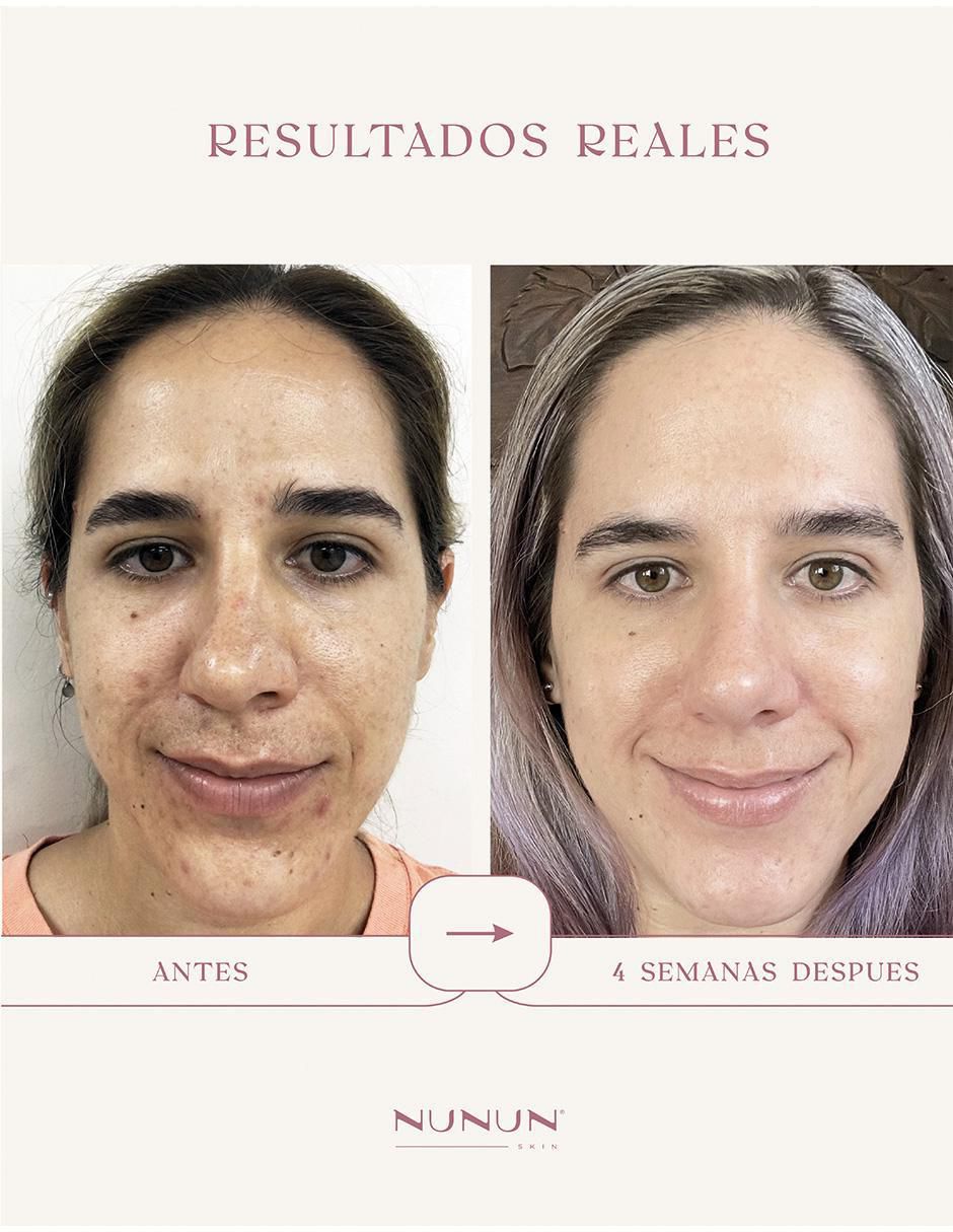 Sérum reafirmante Anti-Aging de piel normales y sensibles 3
