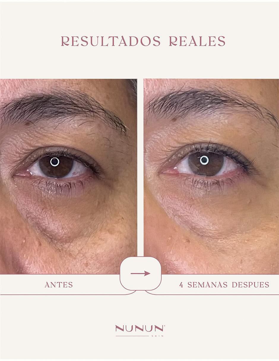 Sérum contorno de ojos todo tipo piel 5