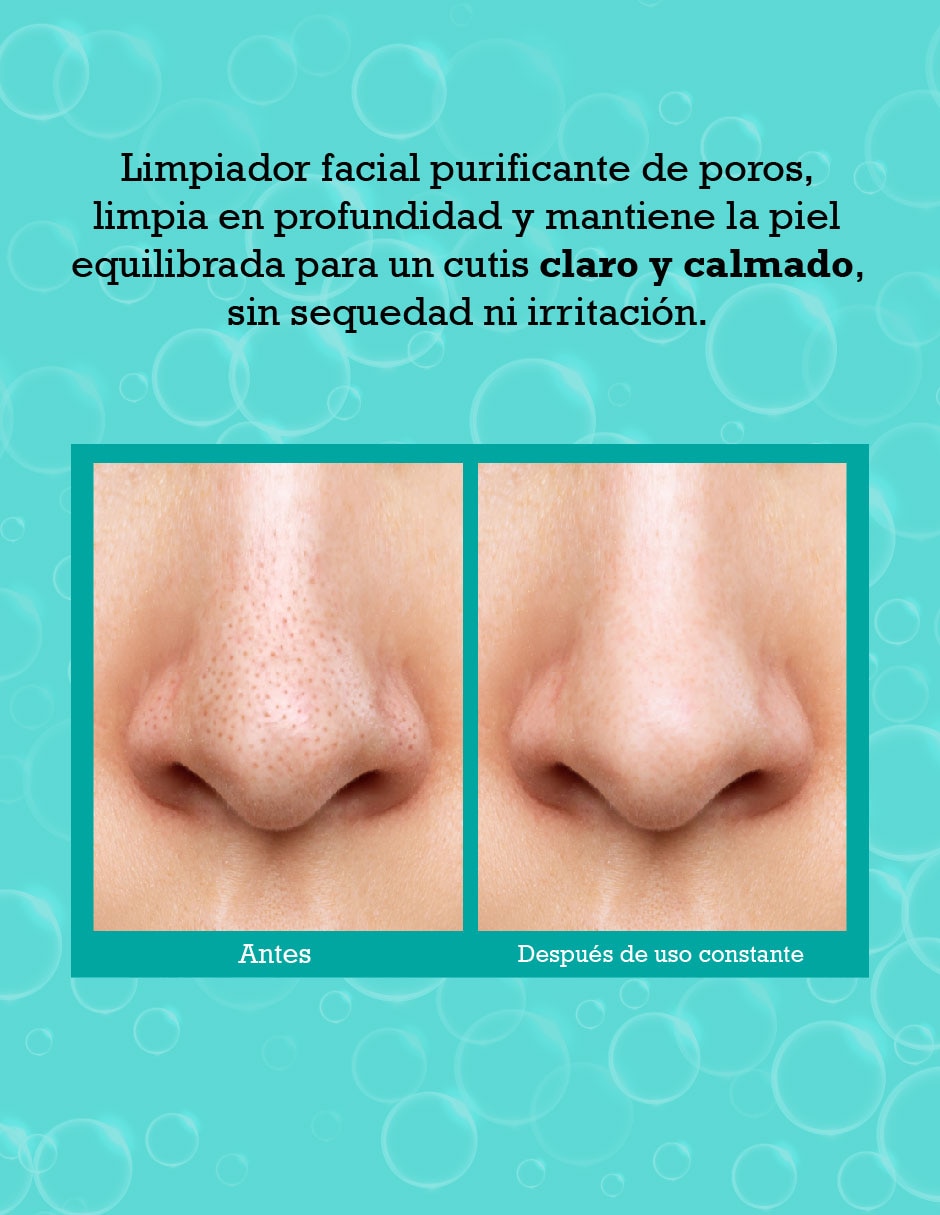 Tratamiento facial Clear Genius Cleanser antiacné 3