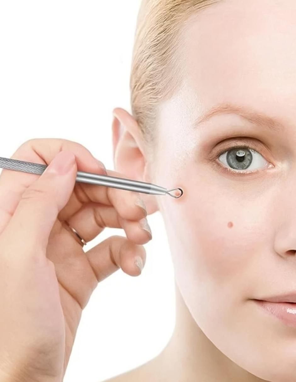 Limpiador facial Removedor de puntos negros para disminuir puntos negros 5
