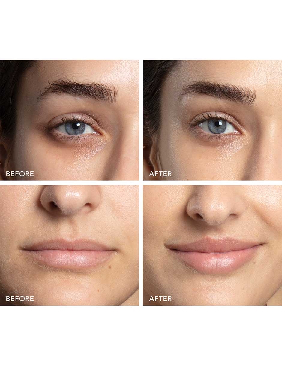 Dispositivo de microcorriente BEAR 2 Eyes & Lips 6