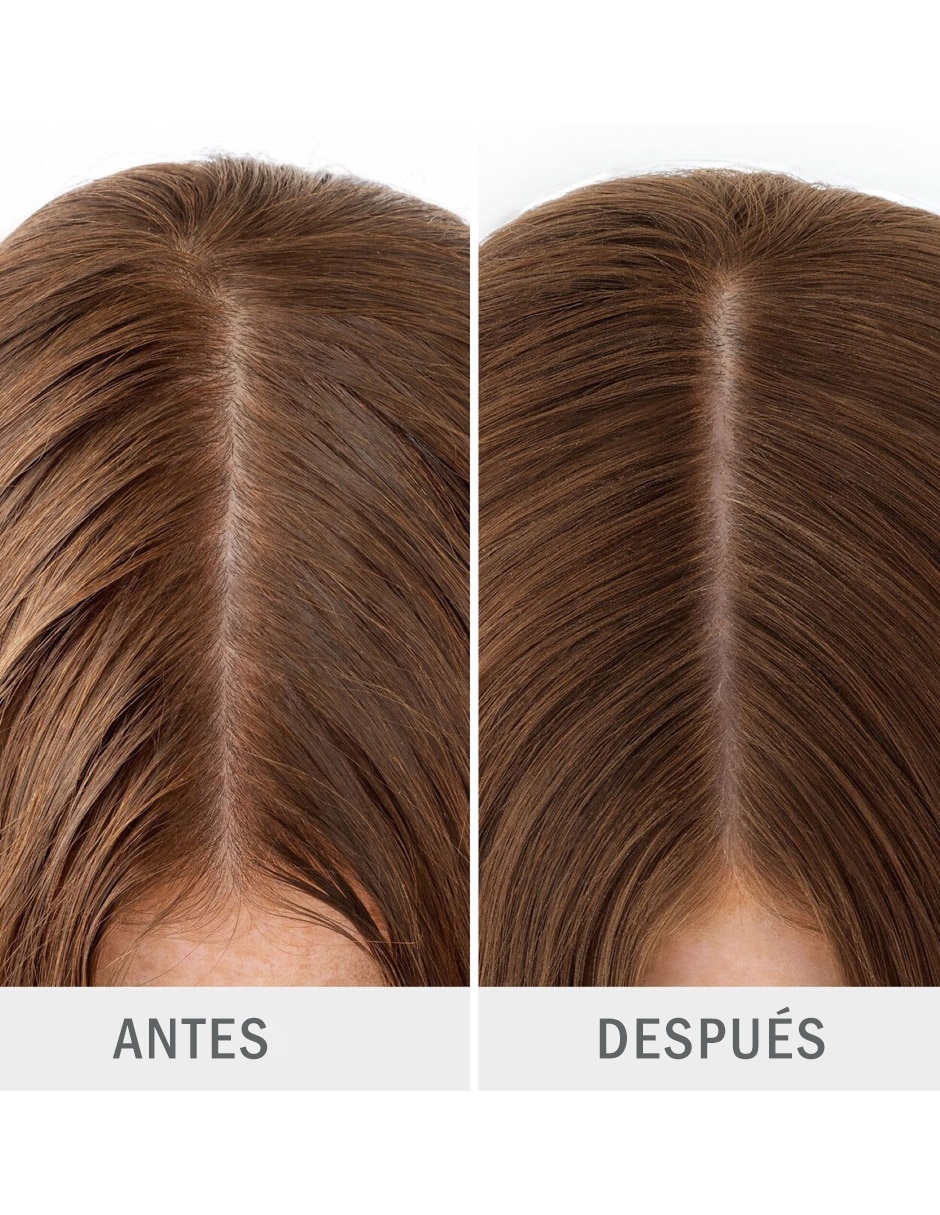 Shampoo en seco para cabello Detox Gentle Detox 5