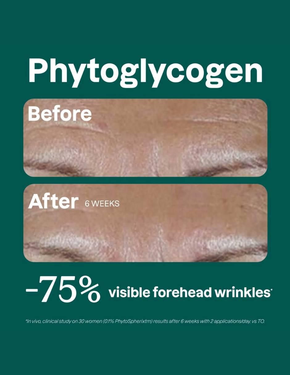 Crema para contorno de ojos recomendada para revitalizar de día y noche Phyto-Glow para todo tipo piel