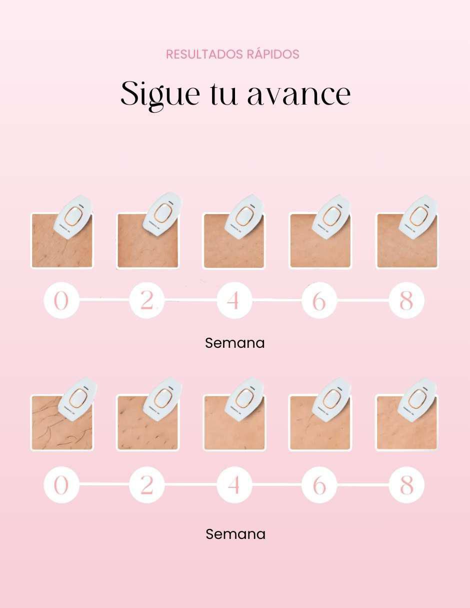 Depiladora ipl "para" rostro y cuerpo shinnyskin shinnyskin