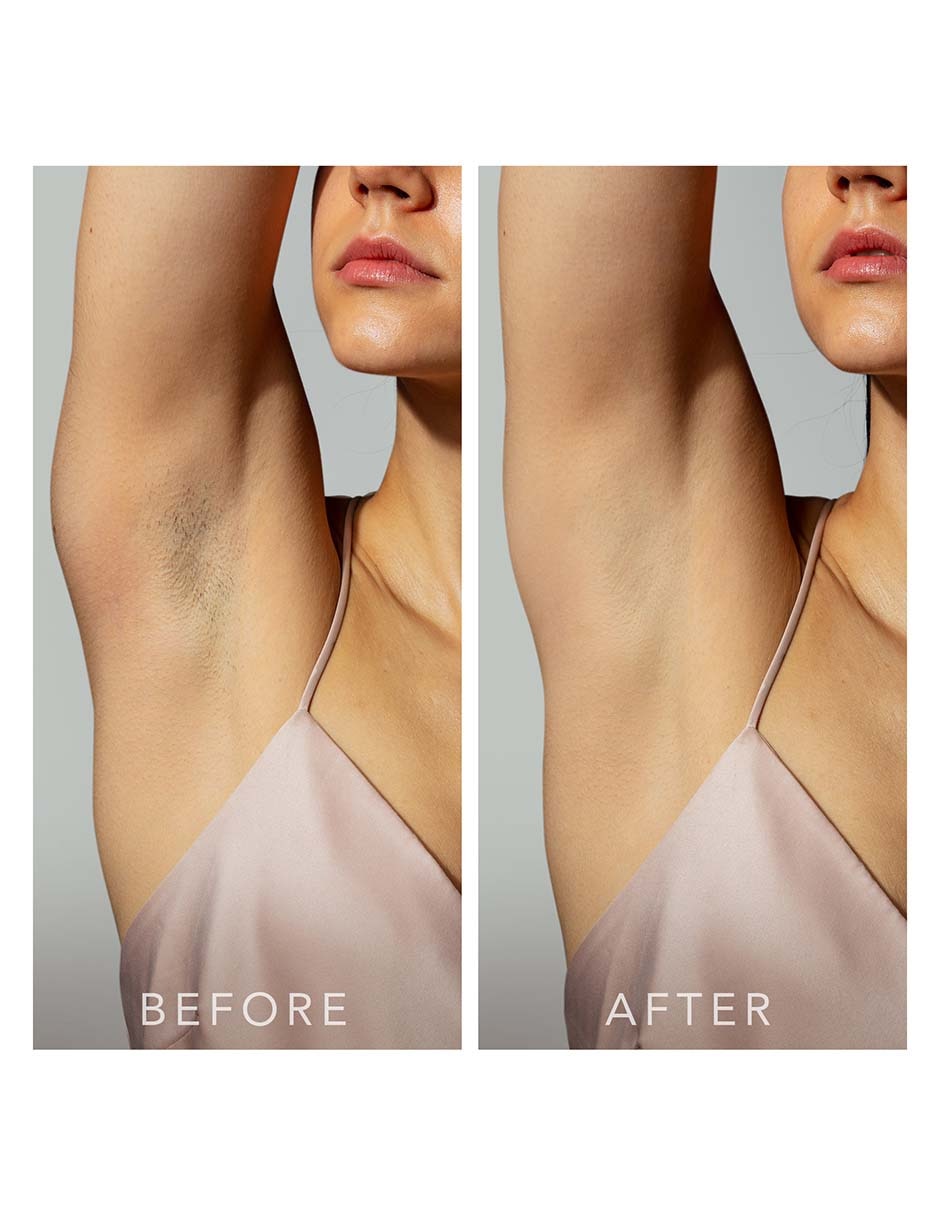 Depiladora IPL para cuerpo Peach 2 5