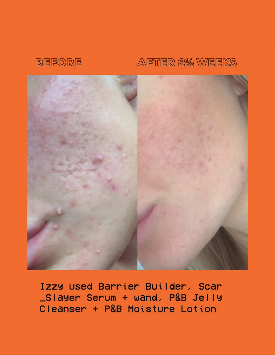 Sérum antimanchas The Vitamin C Scar Slayer todo tipo piel 4