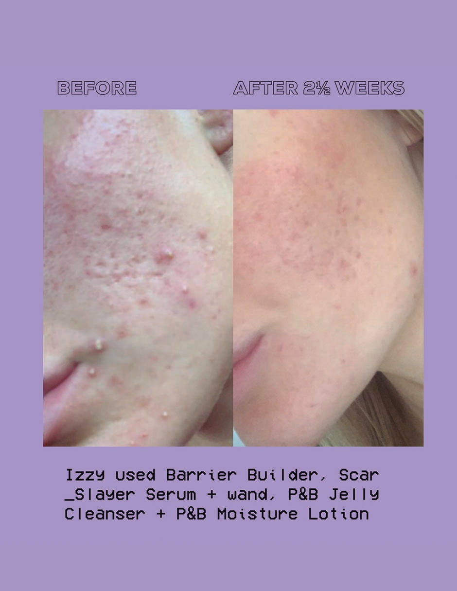 Crema hidratante Purify and Brighten 4