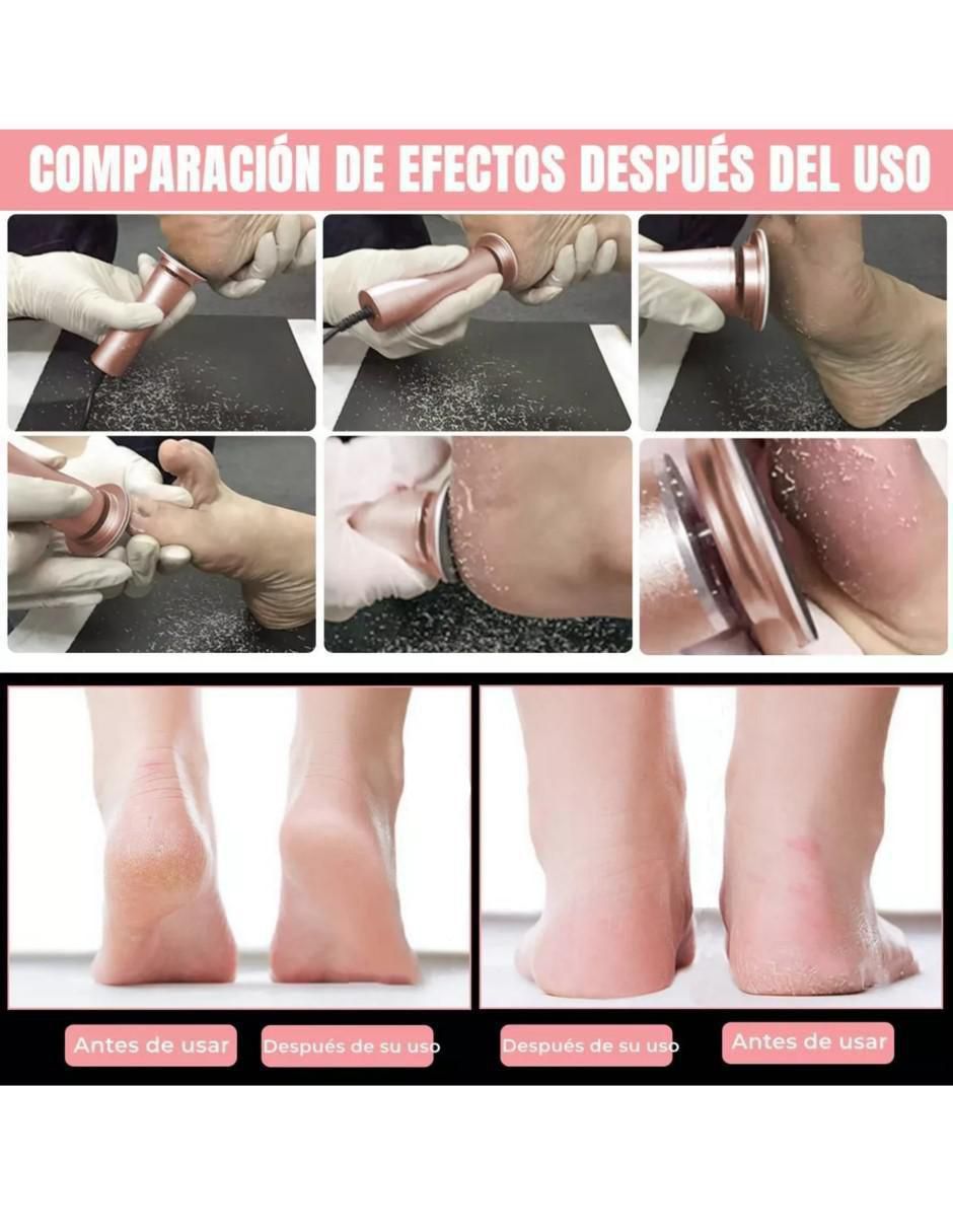 Lima eléctrica para pies 1 cara 5