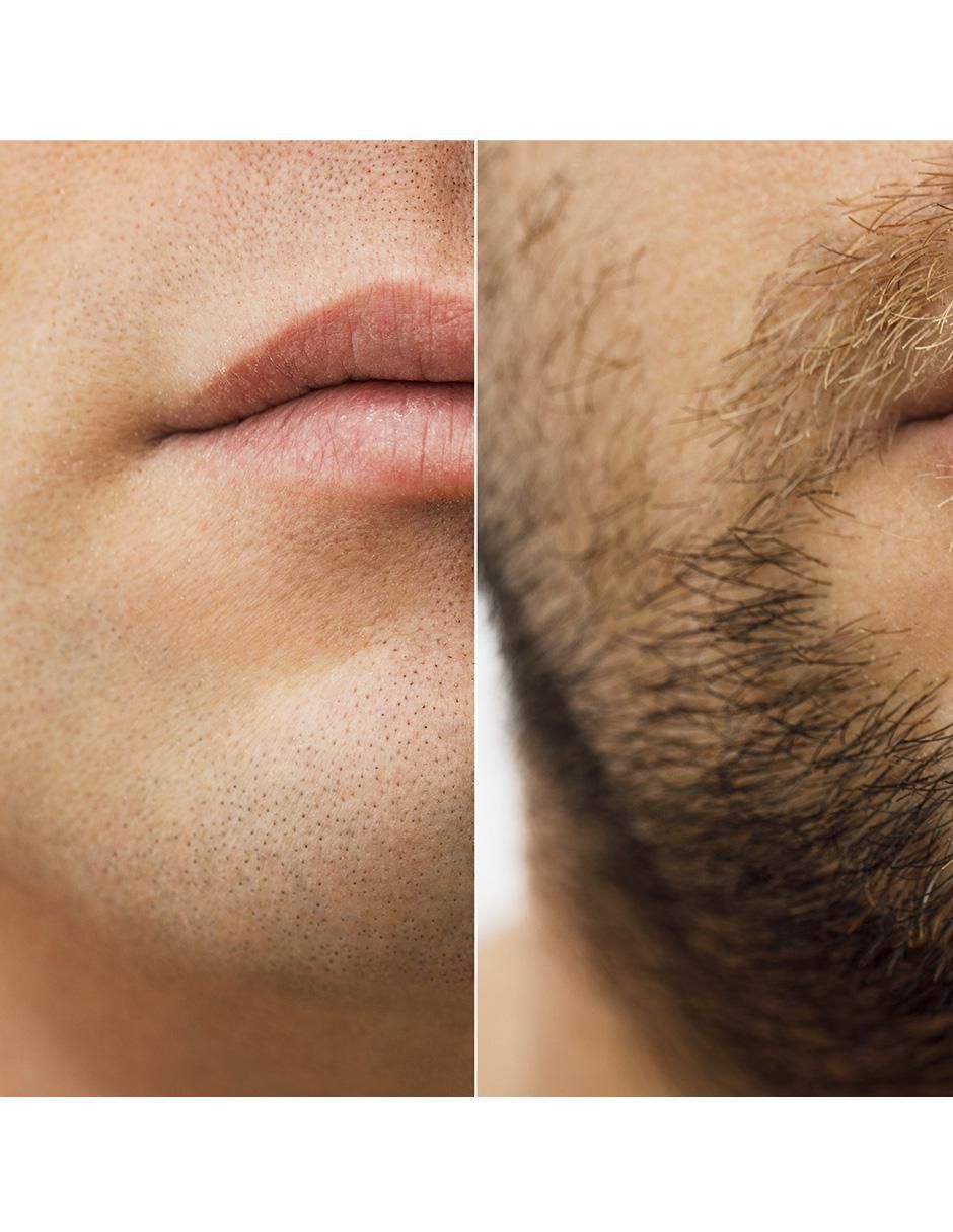 Tratamiento capilar crecimiento 4