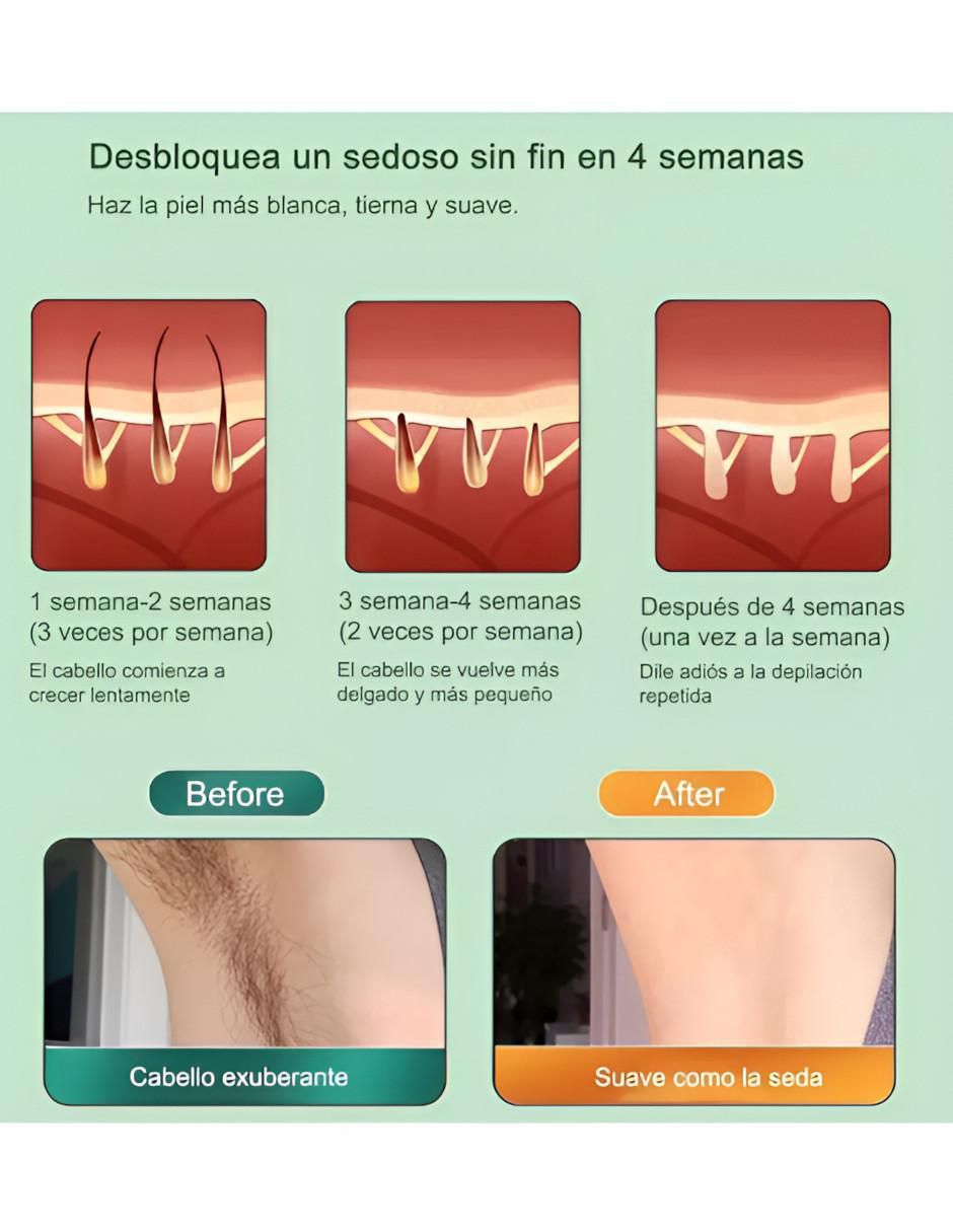 Depiladora IPL para cuerpo 2