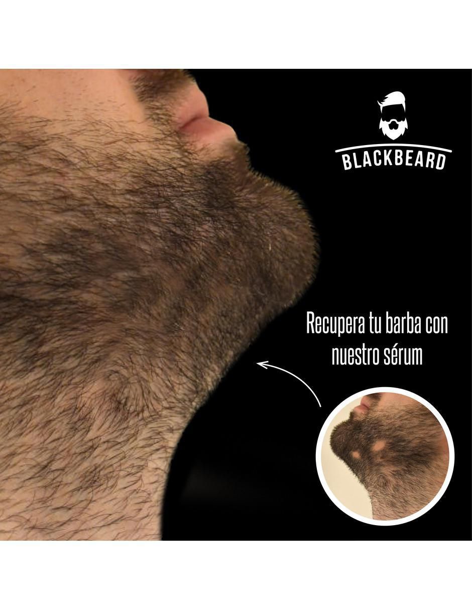 Tratamiento para barba y cabello anticaída 3