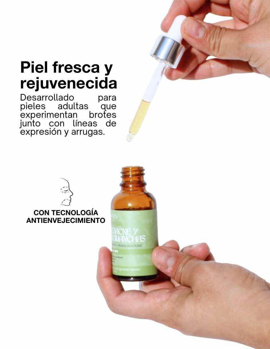 Sérum antiacné de piel grasa 3