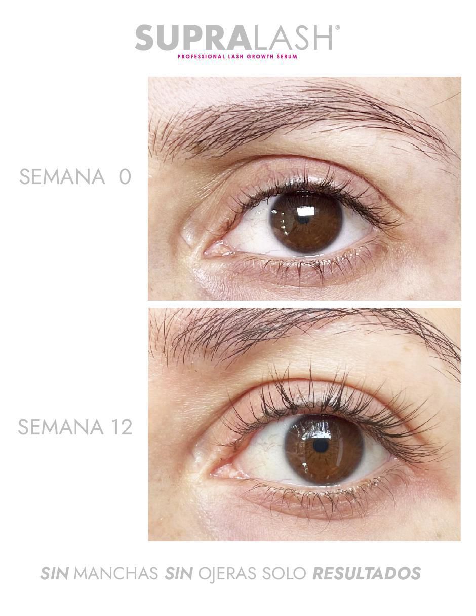 Sérum fortalecedor para pestañas alargador y fortalecedor clínico 2.9 ml de piel normal y sensible 3