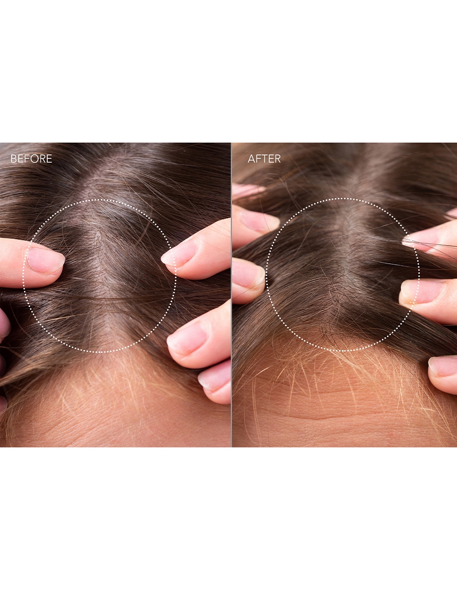 Sérum para cuero cabelludo Scalp Recovery 3