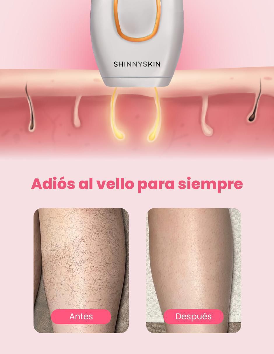 Kit depiladora ipl "para" rostro y cuerpo shinnyskin kit de depilación clásico