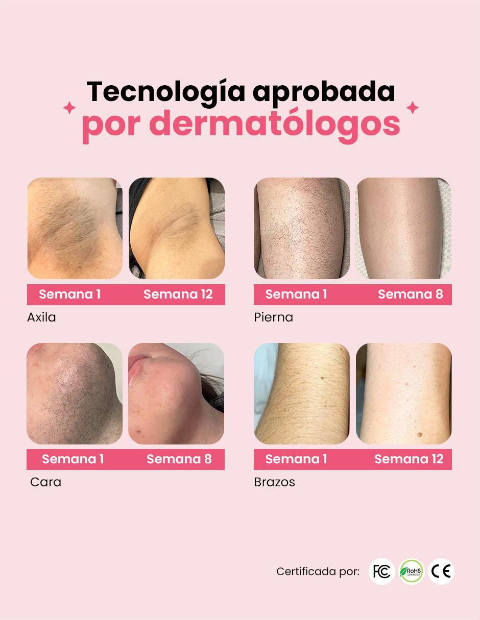 Kit depiladora ipl "para" rostro y cuerpo shinnyskin kit de depilación clásico
