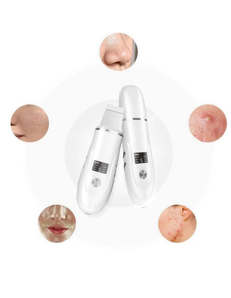 Limpiador facial Ultrasónico para disminuir puntos negros 2
